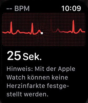 EKG Apple Watch